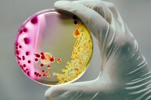 Scegli il tuo Lavello 29 bacteria1